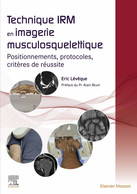 Technique IRM en imagerie musculosquelettique : Positionnements, protocoles, criteres de reussite, EPUB eBook