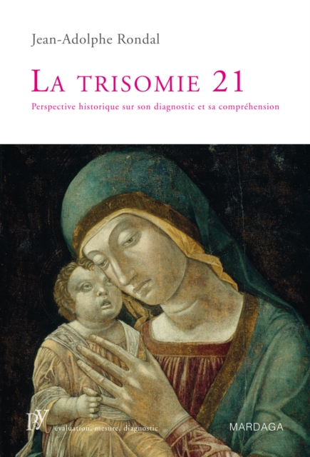 La trisomie 21, EPUB eBook