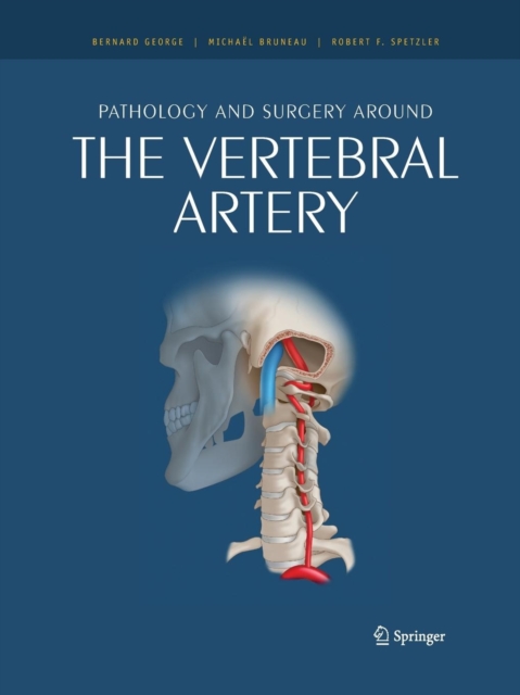 Pathology and surgery around the vertebral artery, Paperback / softback Book