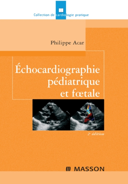Echocardiographie pediatrique et foetale, EPUB eBook