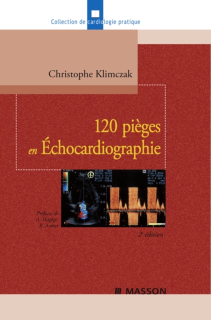 120 pieges en Echocardiographie, EPUB eBook