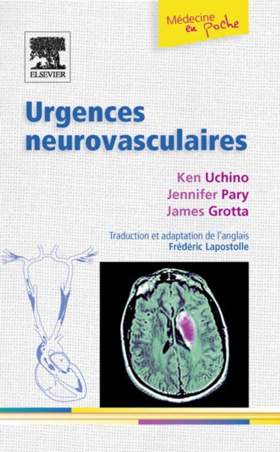 Urgences neurovasculaires, EPUB eBook