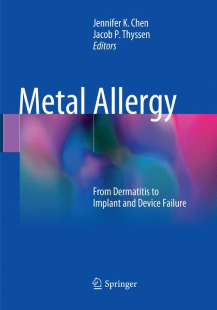 Metal Allergy : From Dermatitis to Implant and Device Failure, Paperback / softback Book