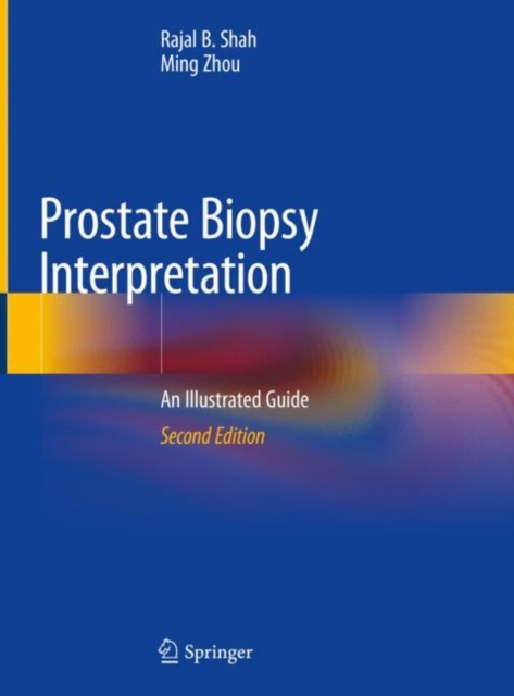 Prostate Biopsy Interpretation : An Illustrated Guide, Hardback Book