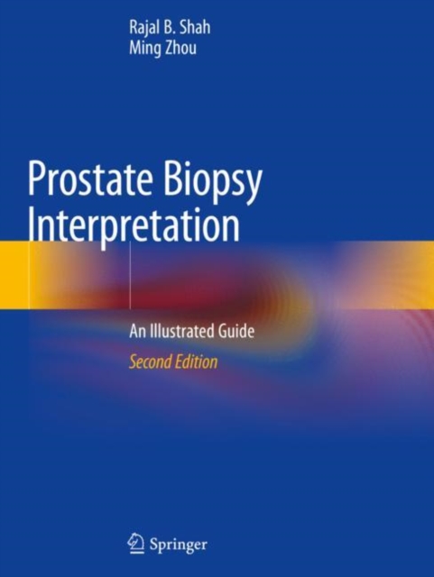 Prostate Biopsy Interpretation : An Illustrated Guide, Paperback / softback Book