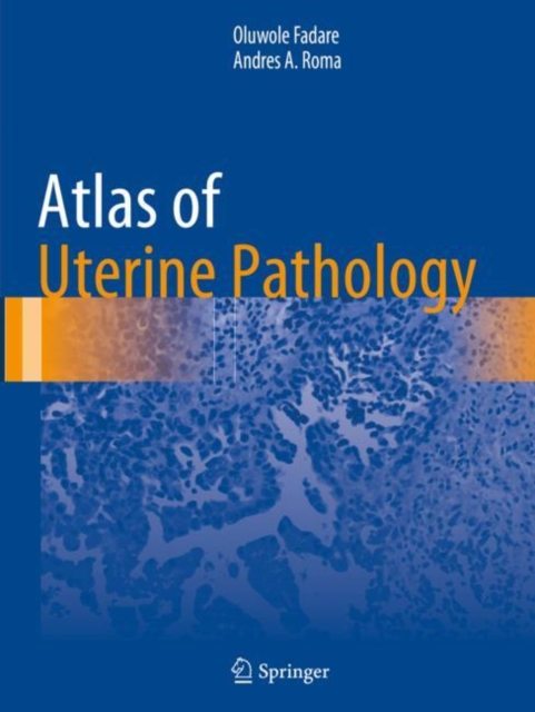 Atlas of Uterine Pathology, Paperback / softback Book