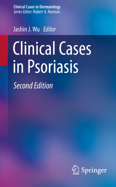 Clinical Cases in Psoriasis, EPUB eBook