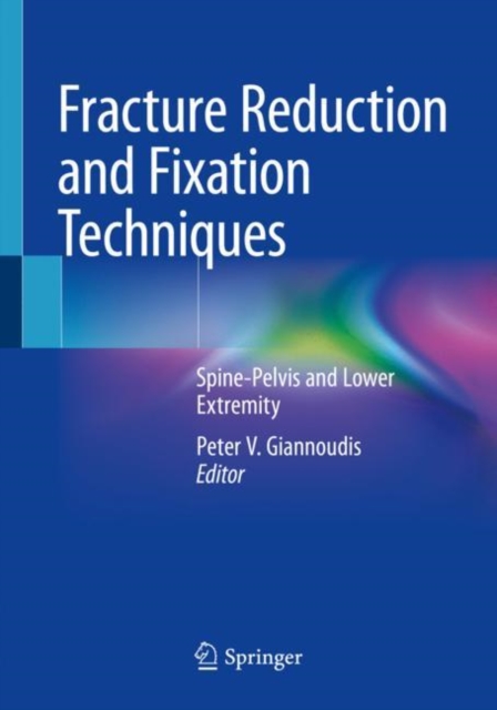 Fracture Reduction and Fixation Techniques : Spine-Pelvis and Lower Extremity, Paperback / softback Book