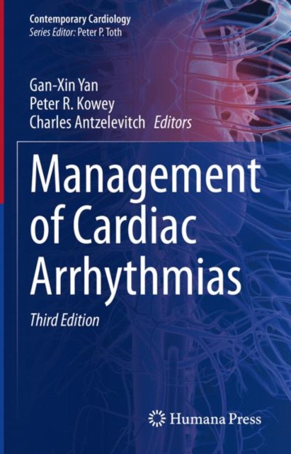 Management of Cardiac Arrhythmias, Hardback Book