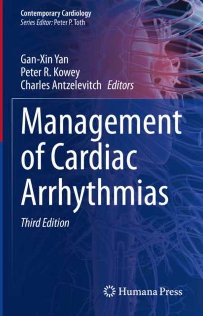 Management of Cardiac Arrhythmias, EPUB eBook