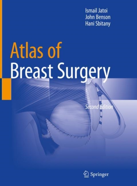 Atlas of Breast Surgery, Hardback Book