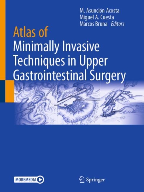 Atlas of Minimally Invasive Techniques in Upper Gastrointestinal Surgery, Hardback Book