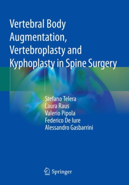 Vertebral Body Augmentation, Vertebroplasty and Kyphoplasty in Spine Surgery, Paperback / softback Book
