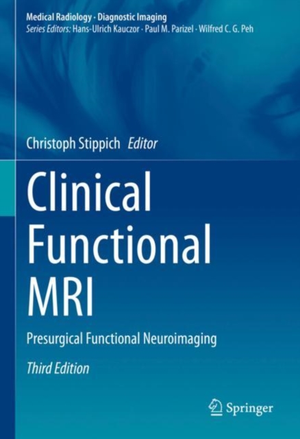 Clinical Functional MRI : Presurgical Functional Neuroimaging, Hardback Book