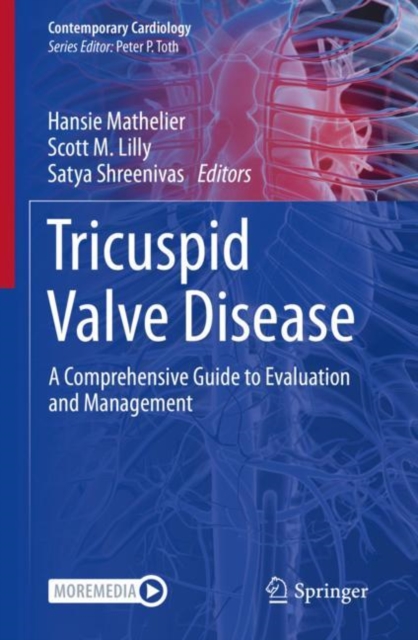 Tricuspid Valve Disease : A Comprehensive Guide to Evaluation and Management, EPUB eBook