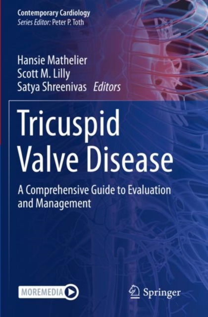 Tricuspid Valve Disease : A Comprehensive Guide to Evaluation and Management, Paperback / softback Book
