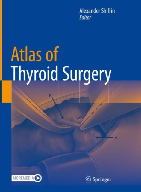 Atlas of Thyroid Surgery, Hardback Book