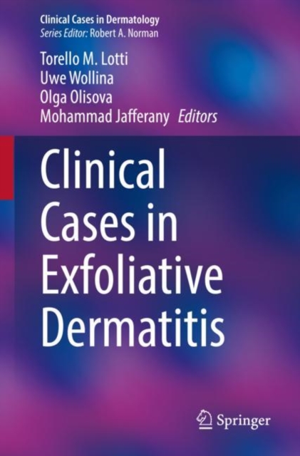 Clinical Cases in Exfoliative Dermatitis, Paperback / softback Book
