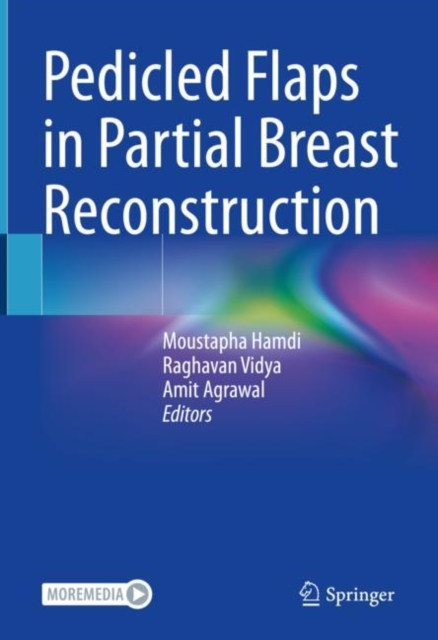 Pedicled Flaps in Partial Breast Reconstruction, Hardback Book