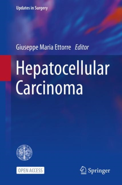 Hepatocellular Carcinoma, EPUB eBook