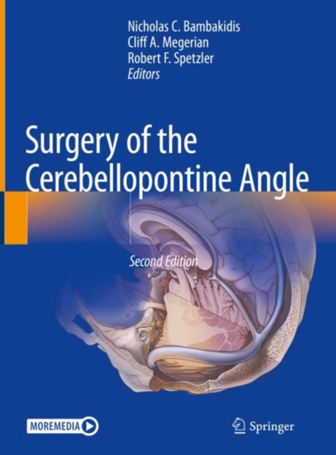 Surgery of the Cerebellopontine Angle, EPUB eBook