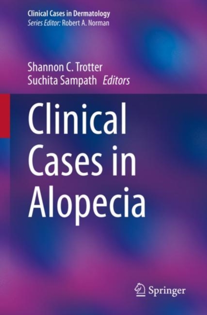 Clinical Cases in Alopecia, Paperback / softback Book