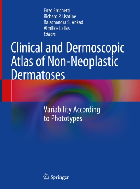 Clinical and Dermoscopic Atlas of Non-Neoplastic Dermatoses : Variability According to Phototypes, EPUB eBook