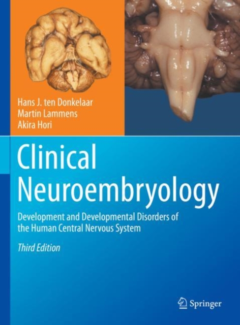Clinical Neuroembryology : Development and Developmental Disorders of the Human Central Nervous System, Hardback Book