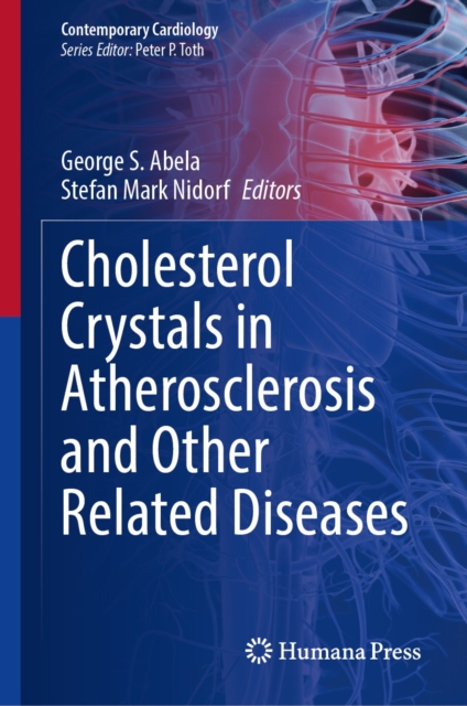 Cholesterol Crystals in Atherosclerosis and Other Related Diseases, EPUB eBook