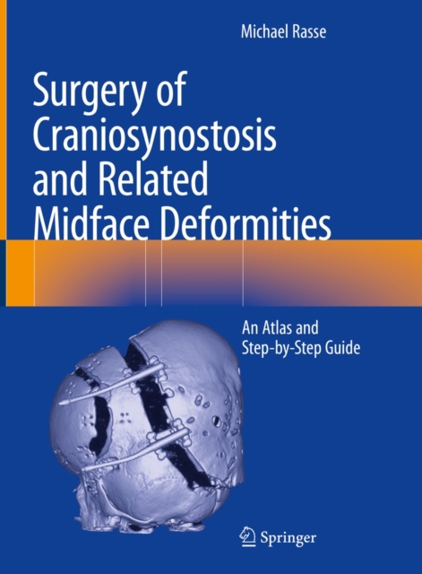 Surgery of Craniosynostosis and Related Midface Deformities : An Atlas and Step-by-Step Guide, EPUB eBook