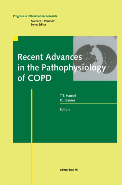 Recent Advances in the Pathophysiology of COPD, PDF eBook