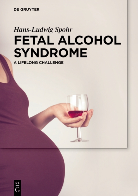 Fetal Alcohol Syndrome : A lifelong Challenge, PDF eBook