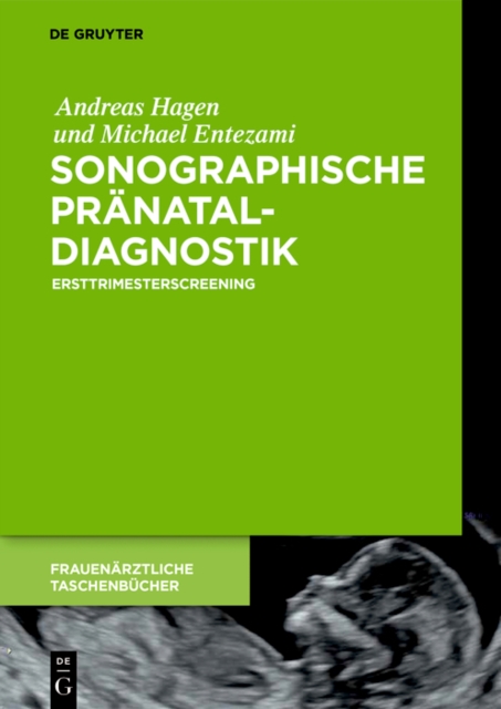 Sonographische Pranataldiagnostik : Ersttrimesterscreening, PDF eBook