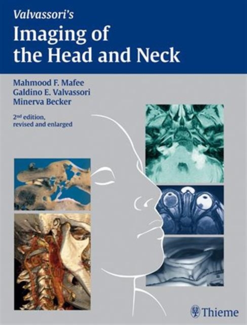 Imaging of the Head and Neck, Hardback Book
