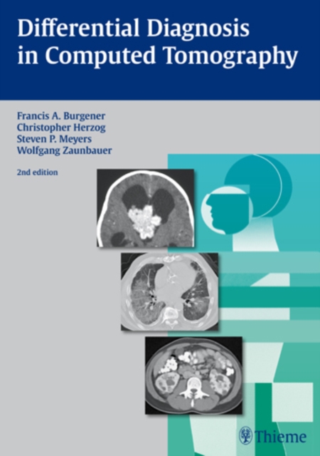 Differential Diagnosis in Computed Tomography, Hardback Book