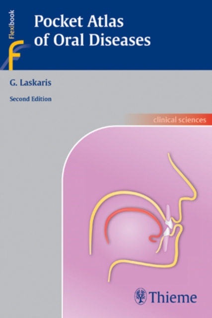 Pocket Atlas of Oral Diseases, Paperback / softback Book