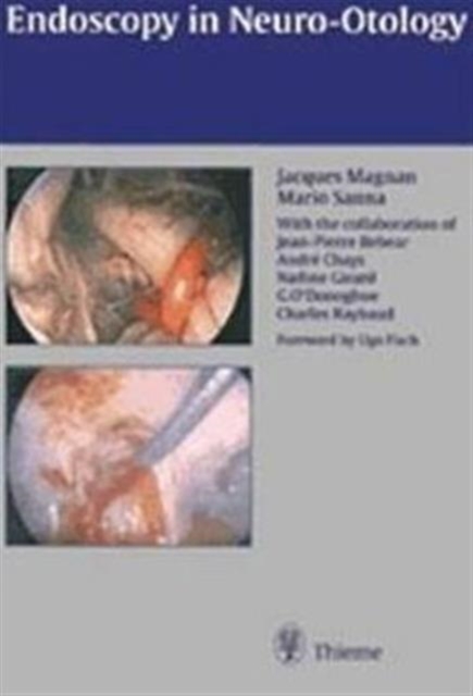 Endoscopy in Neuro-Otology and Skull Base Surgery (AT), Hardback Book