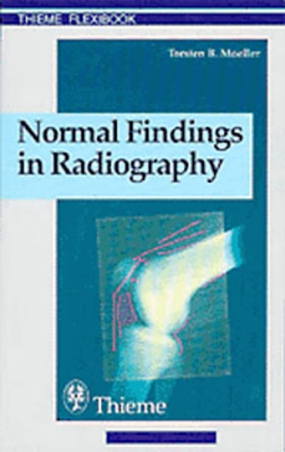 Normal Findings in Radiography, Paperback / softback Book