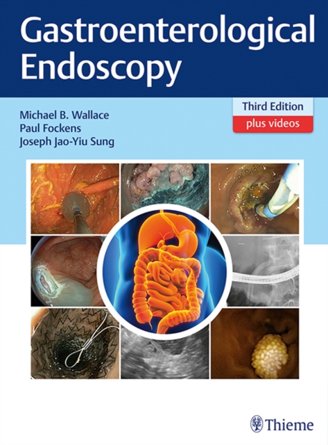 Gastroenterological Endoscopy, Hardback Book