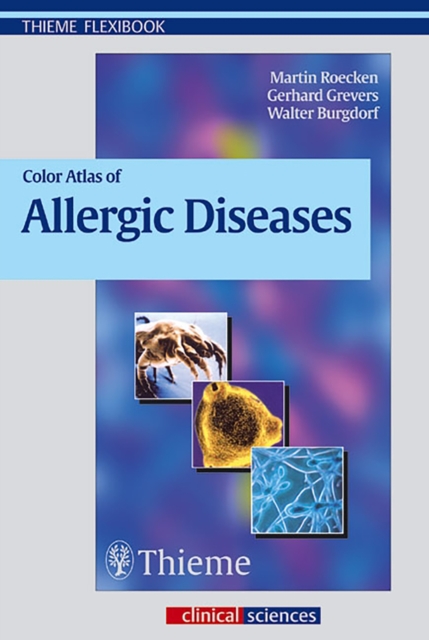 Color Atlas of Allergic Diseases, Paperback / softback Book