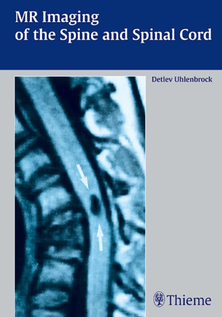 MR Imaging of the Spine and Spinal Cord, Hardback Book