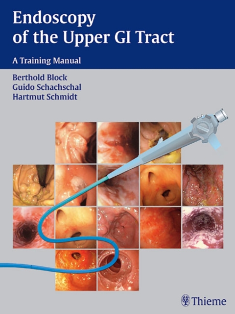 Endoscopy of the Upper GI Tract : A Training Manual, Hardback Book