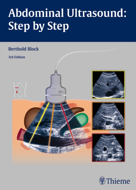Abdominal Ultrasound: Step by Step, Paperback / softback Book