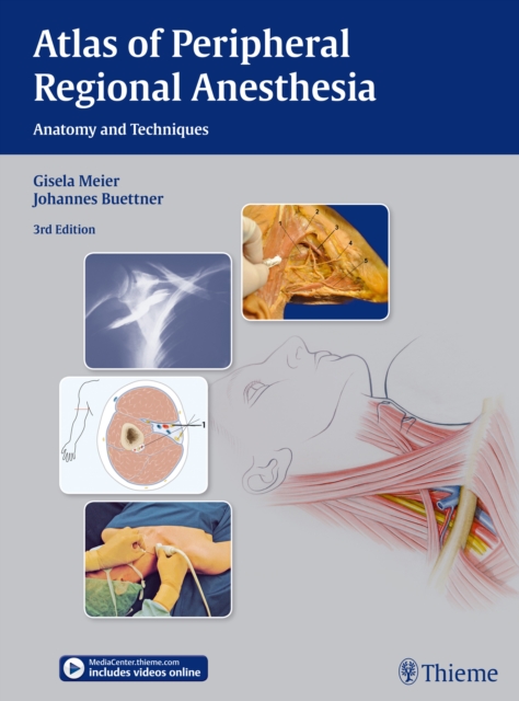 Atlas of Peripheral Regional Anesthesia : Anatomy and Techniques, Hardback Book