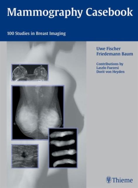 Mammography Casebook : 100 Studies in Breast Imaging, Hardback Book