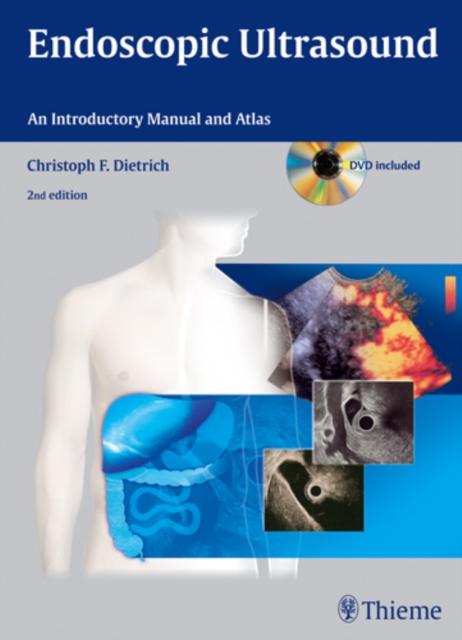 Endoscopic Ultrasound : An Introductory Manual and Atlas, Hardback Book
