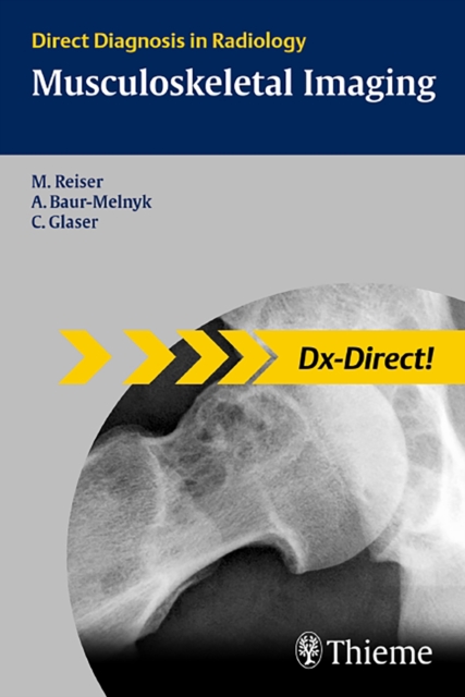 Musculoskeletal Imaging : Direct Diagnosis in Radiology, Paperback / softback Book