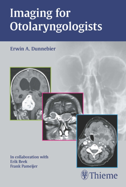 Imaging for Otolaryngologists, Paperback / softback Book