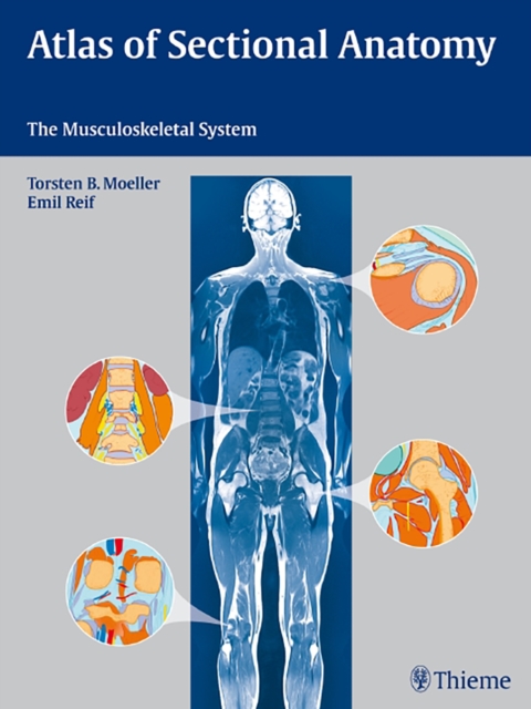 Atlas of Sectional Anatomy : The Musculoskeletal System, Hardback Book