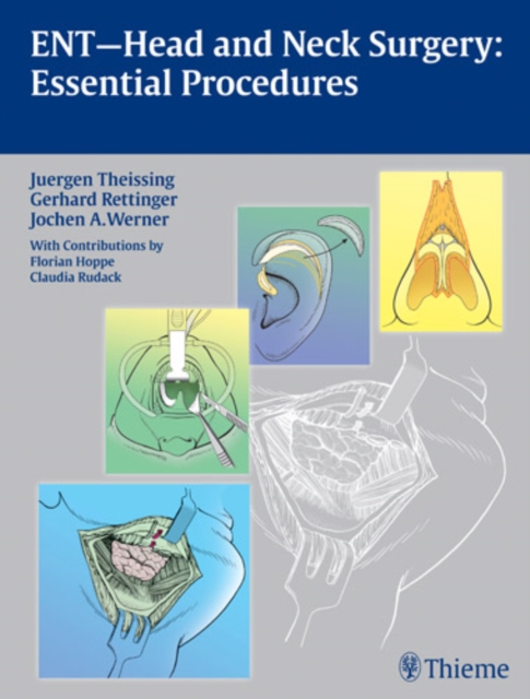 ENT Head and Neck Surgery: Essential Procedures, Hardback Book
